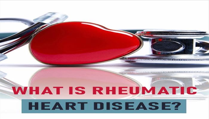 بیماری روماتیسمی دریچه های قلب