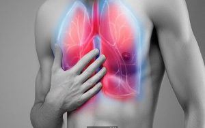 سندرم زجر تنفسی حاد (ARDS)