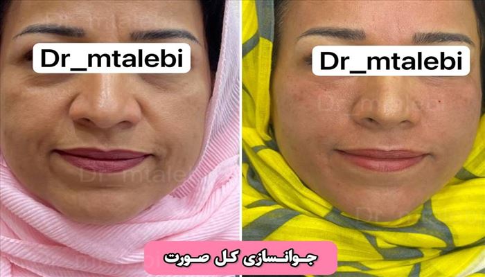 پیری پوست