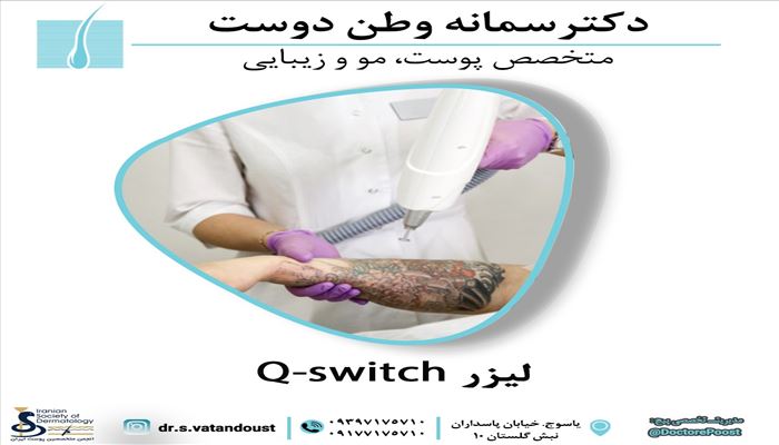 لیزر کیوسییچ Q-SWITCH